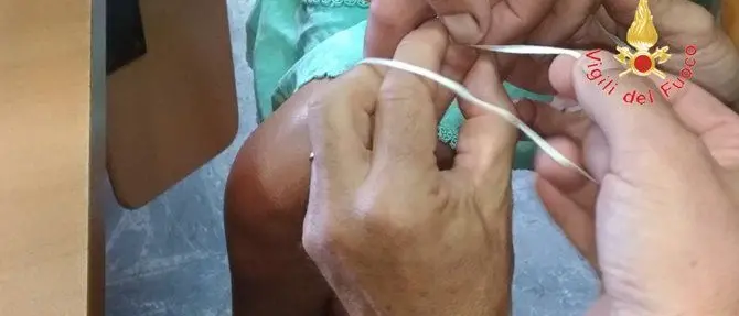 Le si gonfia il dito per via di un anello stretto, intervengono i vigili del fuoco