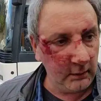 Martone, violenta aggressione ai danni di un autista bus
