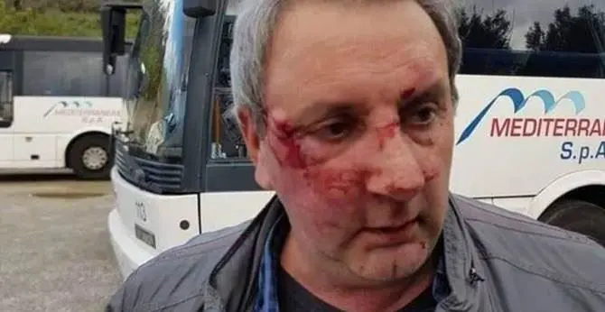 Martone, violenta aggressione ai danni di un autista bus