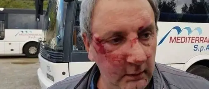 Martone, violenta aggressione ai danni di un autista bus