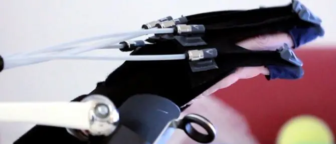 Robotica e riabilitazione, focus sui vantaggi dell'intelligenza artificiale