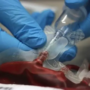 Reggio, l’appello dei donatori: «Manca sangue in città, intervenite»