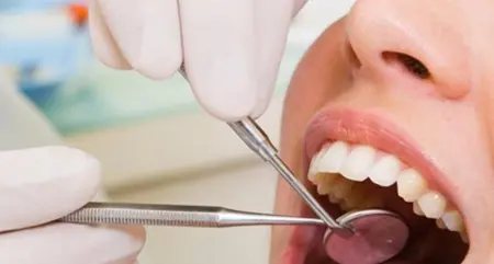 Non dichiara redditi per oltre 400mila euro, scoperto dentista evasore totale a Cosenza