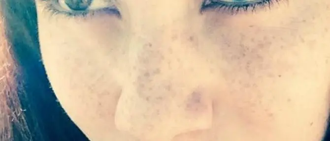 Parla Vanessa: «Non sono una guerriera, ma combatto per vivere»