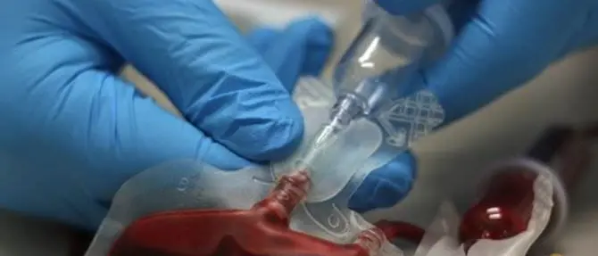 “Sangue infetto”: il Tribunale di Cosenza decide per 2 condanne e una assoluzione