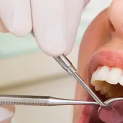 Denunciato dentista abusivo a Bagnara