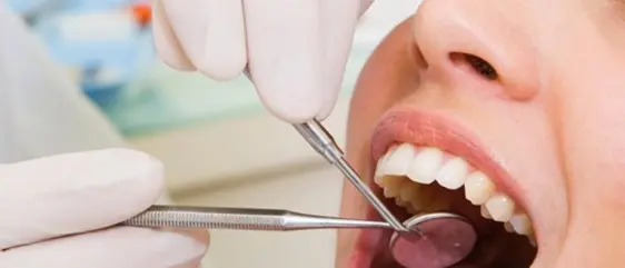 Belvedere Marittimo: scoperto falso dentista, due denunce