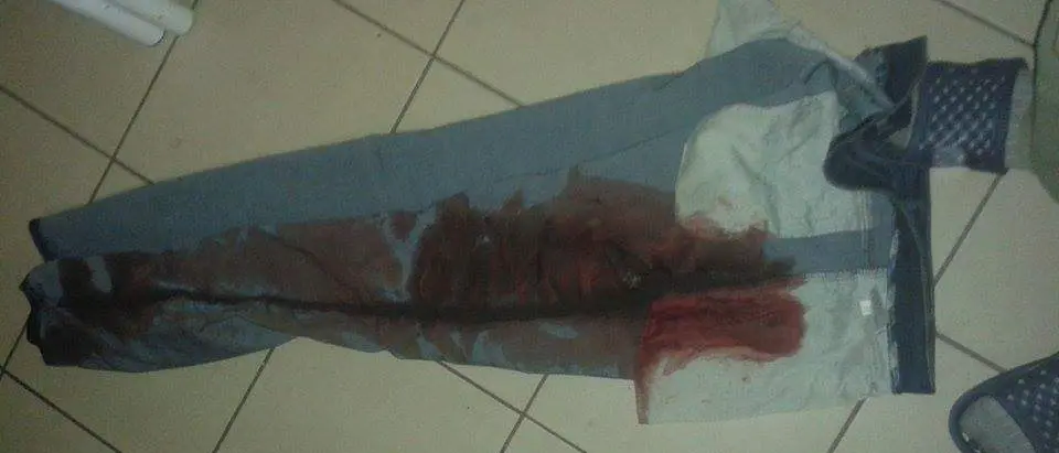 Briatico (VV): aggrediti due migranti, cinque denunce