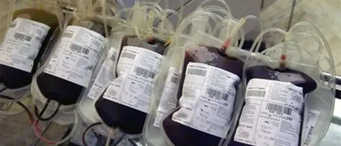 Sangue infetto a Cosenza, quattro rinvii a giudizio e due assoluzioni
