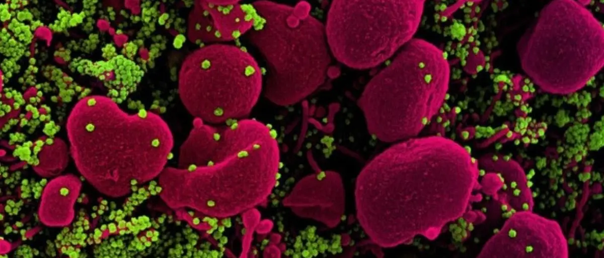 Covid, la variante KP3 minaccia le vacanze estive: ecco come proteggersi e riconoscere i sintomi