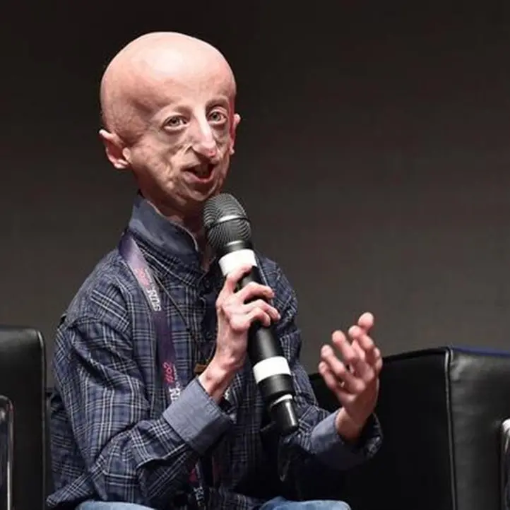 È morto a 28 anni Sammy Basso, una vita spesa a far conoscere la progeria: malattia rarissima che colpisce 100 persone in tutto il mondo