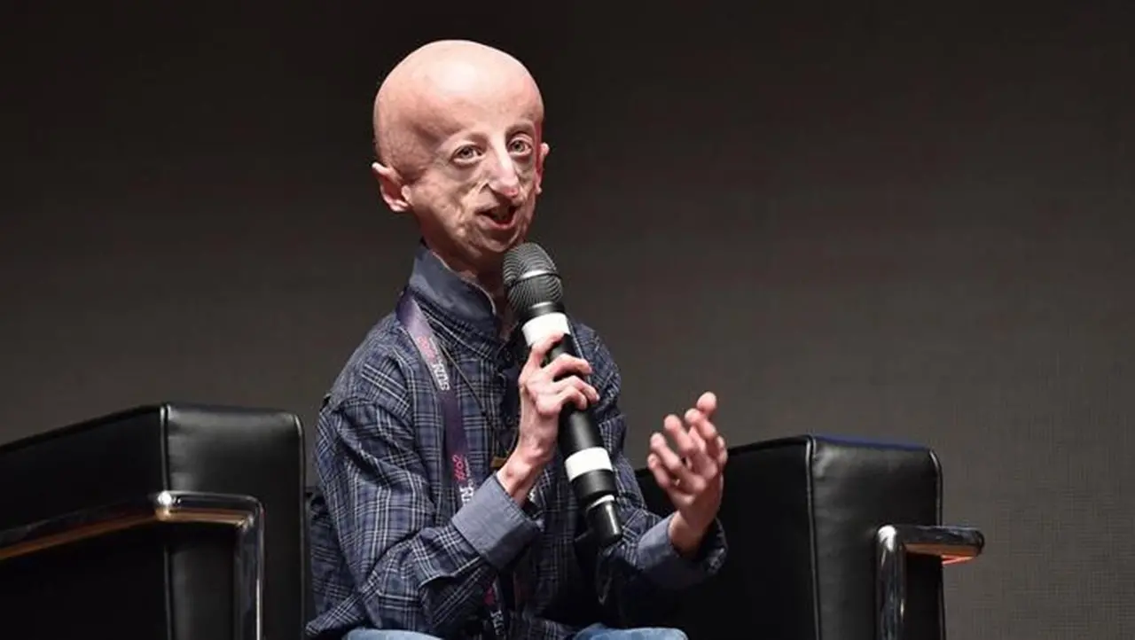 È morto a 28 anni Sammy Basso, una vita spesa a far conoscere la progeria: malattia rarissima che colpisce 100 persone in tutto il mondo