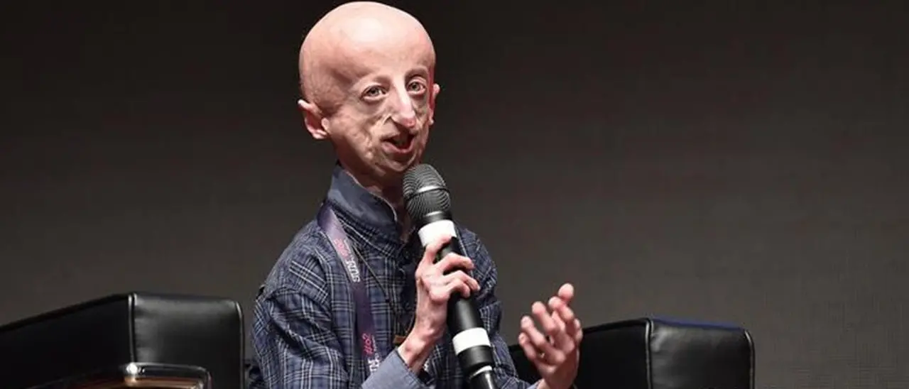 È morto a 28 anni Sammy Basso, una vita spesa a far conoscere la progeria: malattia rarissima che colpisce 100 persone in tutto il mondo
