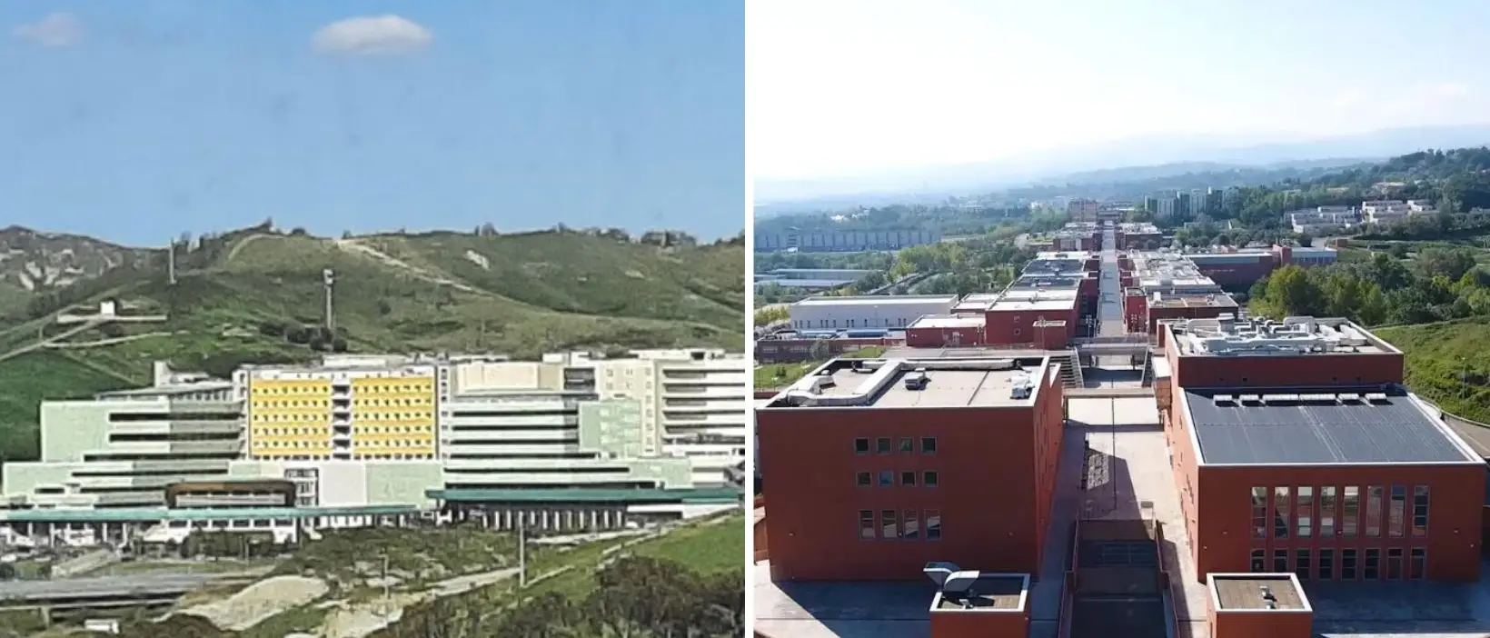 L’intelligenza artificiale per la cura dell’ictus: il progetto della Dulbecco in collaborazione con l’Unical