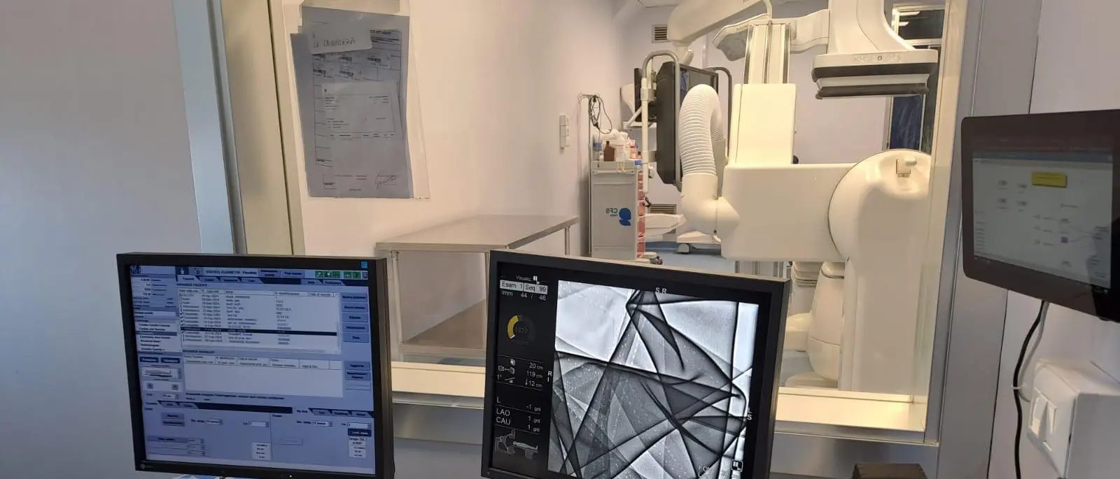 Paola, due milioni di euro per una sala di emodinamica mai utilizzata. E i pazienti vengono trasferiti altrove