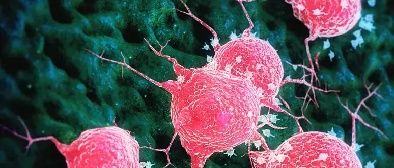 Tumori, le metastasi non sono più una sentenza definitiva: «Dati sulla sopravvivenza in aumento»