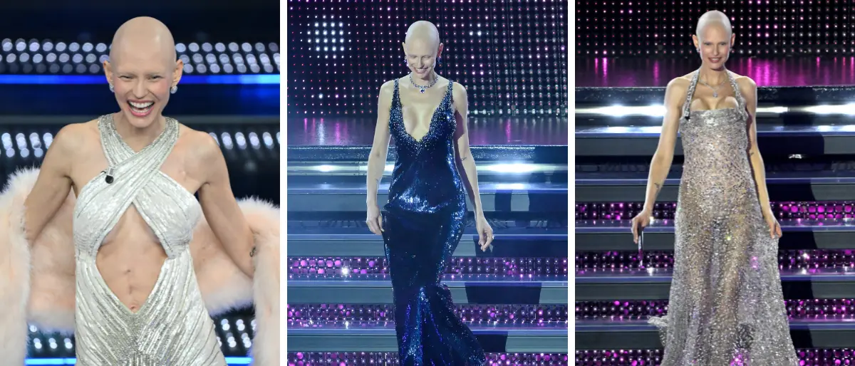 Sanremo 2025, Bianca Balti e la cicatrice in vista: «Senza capelli passo meno tempo allo specchio»\n