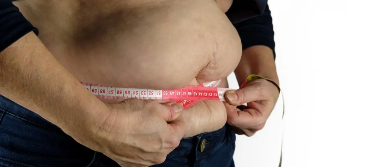 Obesità, a Cosenza visite gratuite\u00A0in vista della Giornata mondiale\n