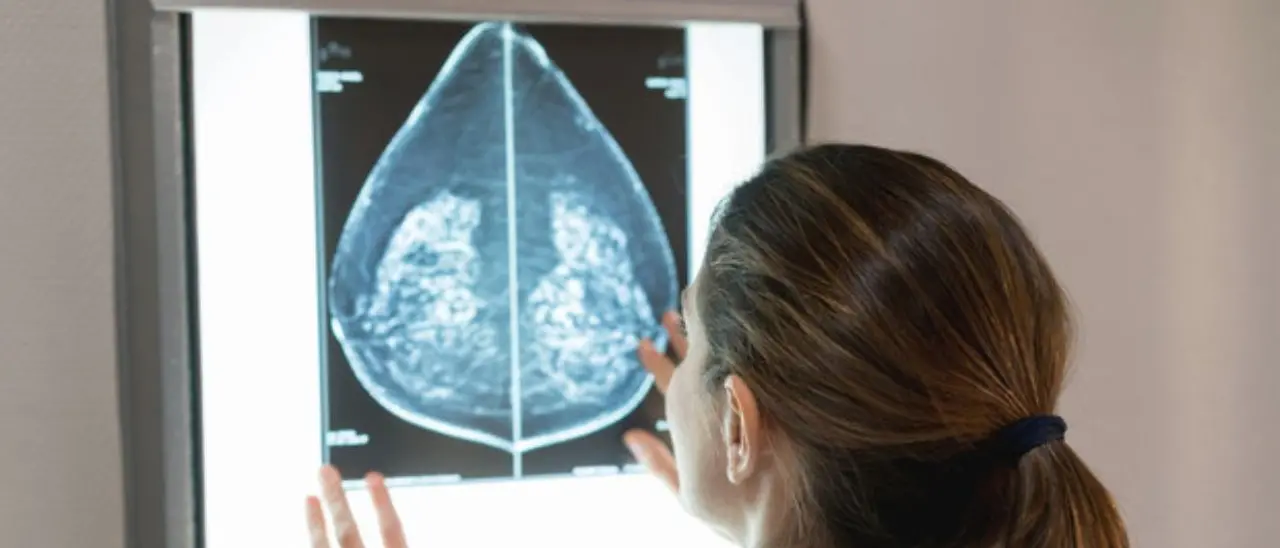 Tumore al seno, con l’Intelligenza artificiale diagnosi più precoci e precise: «Individua anche i segnali piccolissimi»