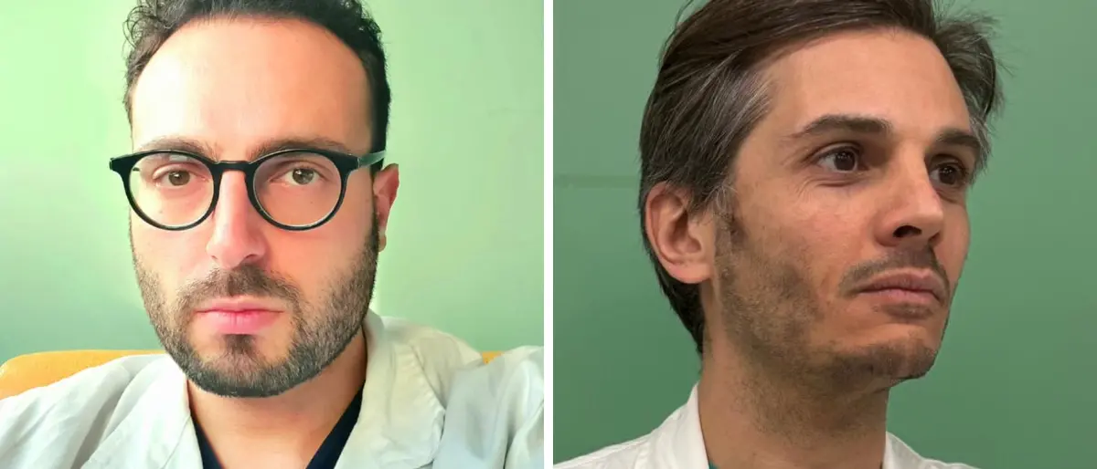 Due medici calabresi al vertice della\u00A0federazione europea degli ortopedici under 40