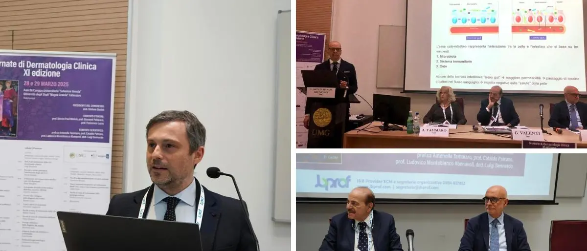 Le sfide della dermatologia in Calabria tra reparti ridimensionati e necessità di fare rete per arginare la migrazione sanitaria\n