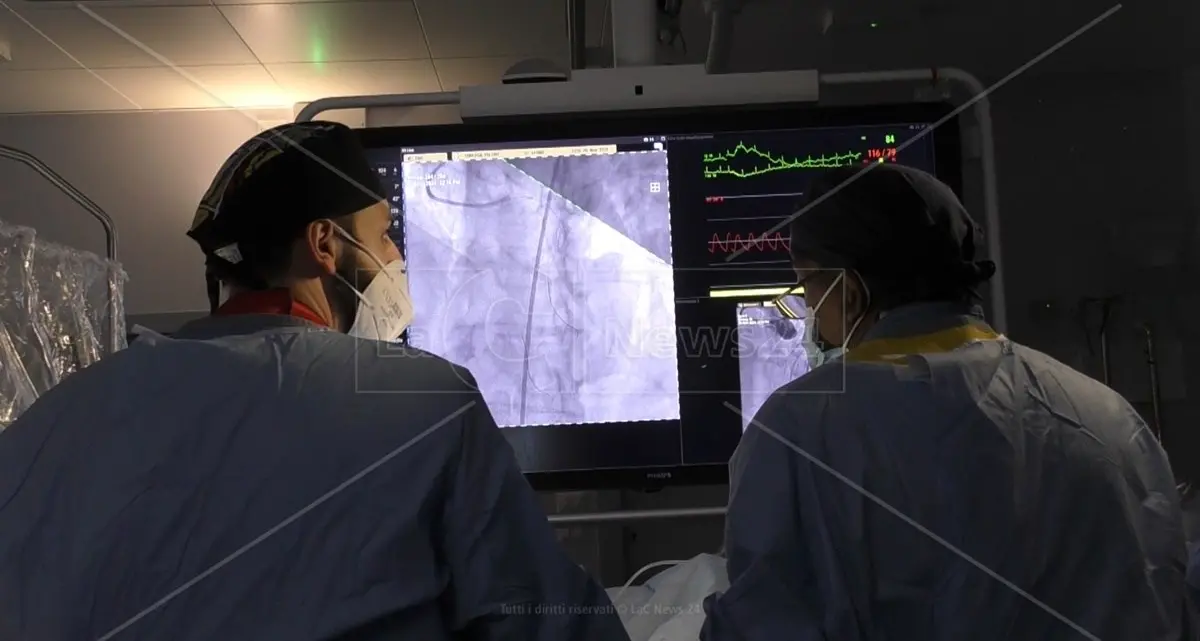 A Cosenza primo impianto di valvola aortica senza bisturi grazie a convenzione con il Gom di Reggio: «Sempre più calabresi potranno curarsi a casa»