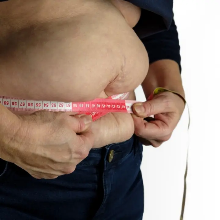 L’Italia riconosce l’obesità come malattia: la Camera approva la legge, ora tocca al Senato\n