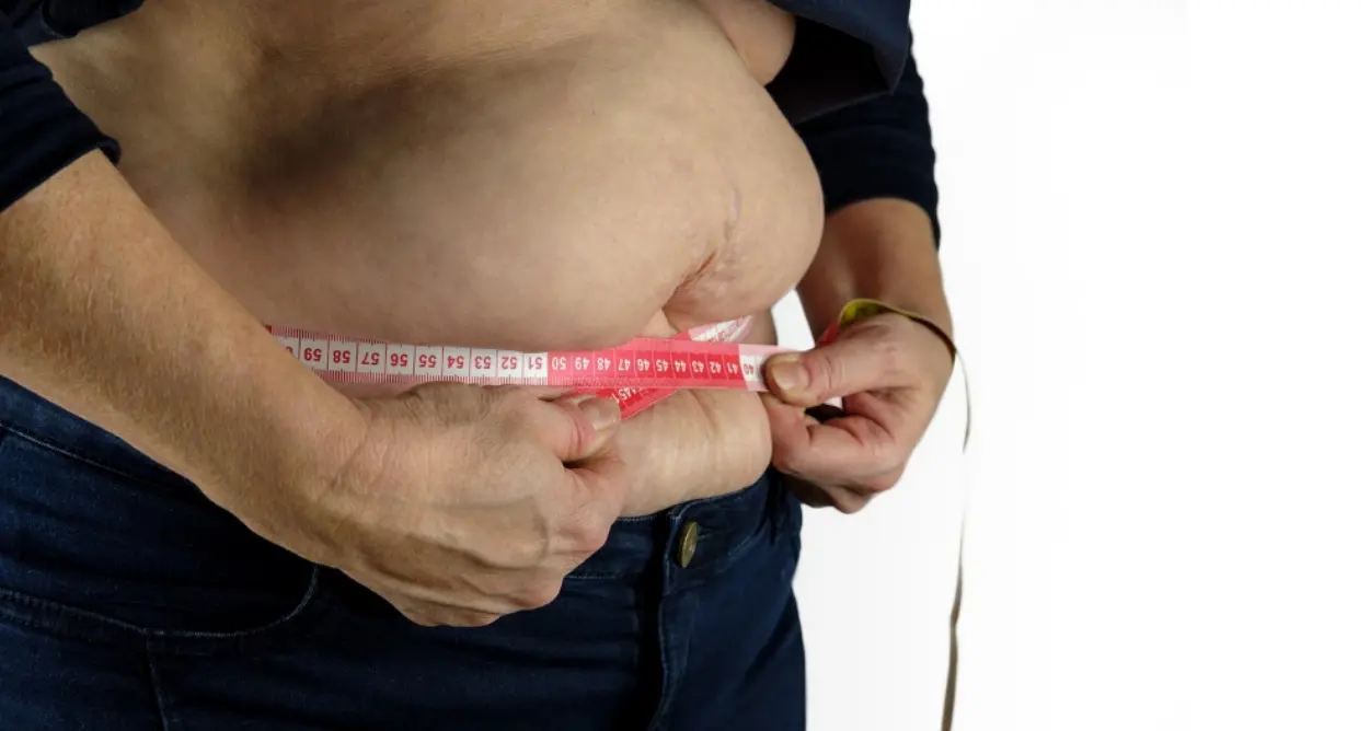 L’Italia riconosce l’obesità come malattia: la Camera approva la legge, ora tocca al Senato\n