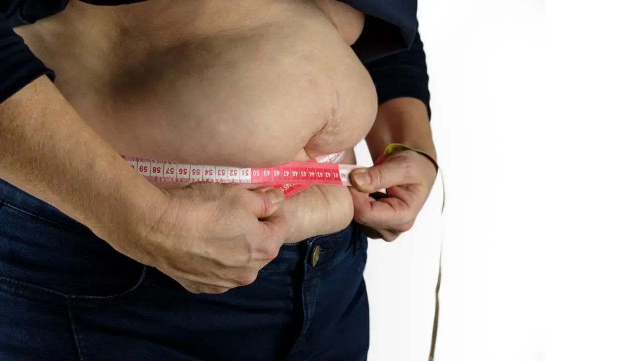 L’Italia riconosce l’obesità come malattia: la Camera approva la legge, ora tocca al Senato\n
