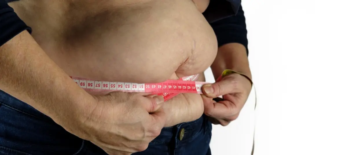 L’Italia riconosce l’obesità come malattia: la Camera approva la legge, ora tocca al Senato\n