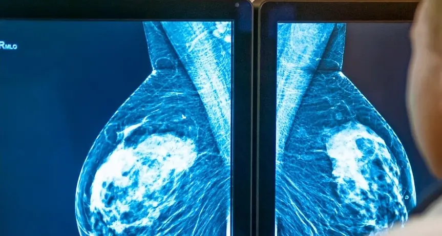 Screening oncologici, Calabria ultima per adesione. Gimbe: «Regioni devono fare di più, diagnosi precoce fondamentale»