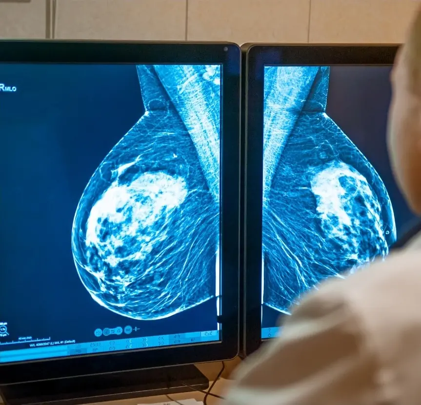 Calabria ultima per adesione agli screening oncologici, Gimbe: «Regioni devono fare di più, diagnosi precoce fondamentale»