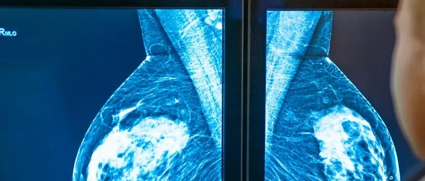 Calabria ultima per adesione agli screening oncologici, Gimbe: «Regioni devono fare di più, diagnosi precoce fondamentale»