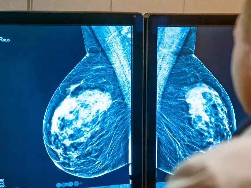 Calabria ultima per adesione agli screening oncologici, Gimbe: «Regioni devono fare di più, diagnosi precoce fondamentale»