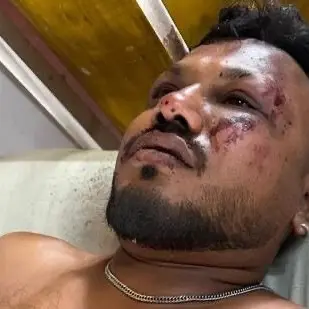 «Mi sono alzato tra le fiamme e ho cominciato a correre»: il racconto dell’unico sopravvissuto al disastro di Air India\n