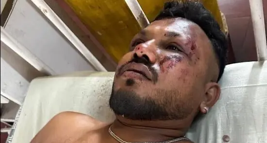 «Mi sono alzato tra le fiamme e ho cominciato a correre»: il racconto dell’unico sopravvissuto al disastro di Air India\n