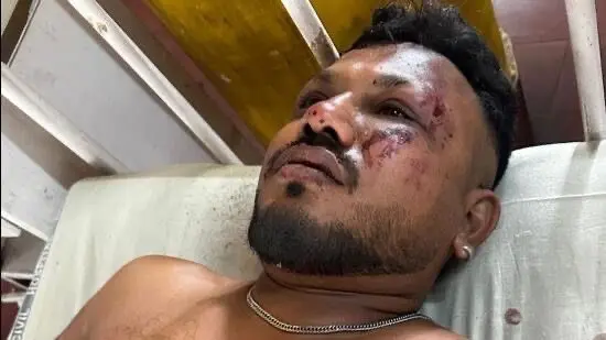 «Mi sono alzato tra le fiamme e ho cominciato a correre»: il racconto dell’unico sopravvissuto al disastro di Air India\n