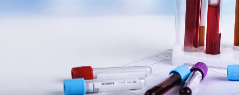 Test sierologici, scelto un campione di 150mila persone: si inizia domani
