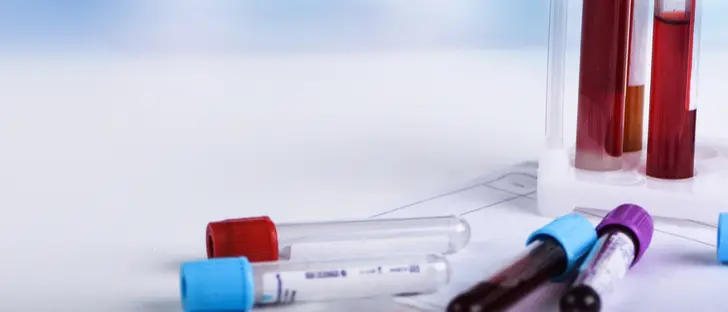 Test sierologici, scelto un campione di 150mila persone: si inizia domani