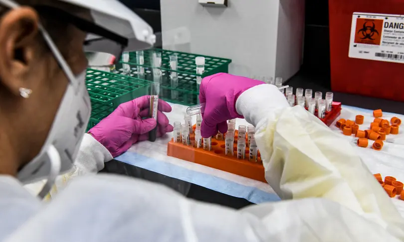 Casale Monferrato si candida a conservare il vaccino anti-coronavirus: i dettagli