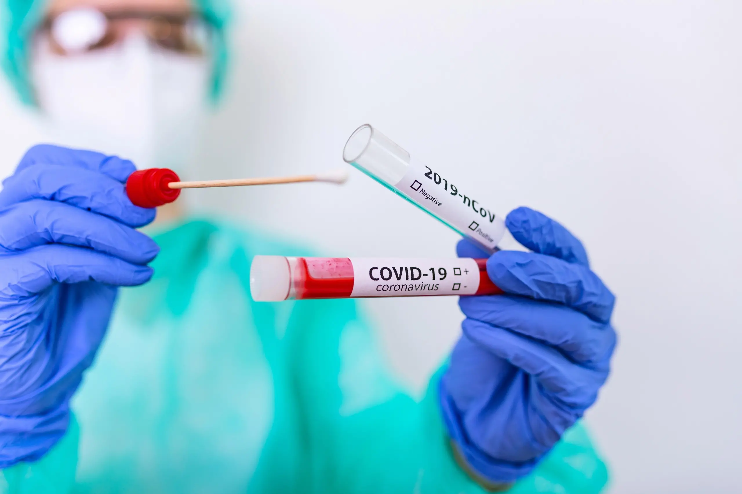 Covid, tamponi antigenici rapidi al Centro Sanitario Unical