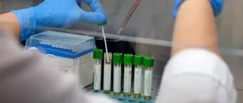 Cosenza, anticorpi monoclonali per pazienti Covid non gravi