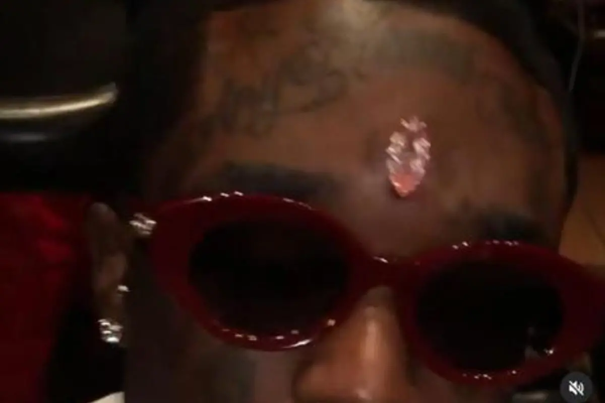 Un diamante in fronte, il rapper spende 24 milioni