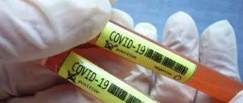 Covid Piemonte, oggi 669 nuovi contagi e 18 morti: bollettino