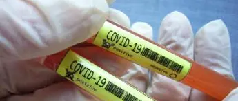 Covid Toscana, 894 nuovi casi: il bollettino