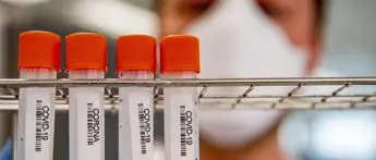 Covid Emilia, 1.847 nuovi contagi e 23 morti: bollettino