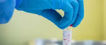 Covid Basilicata, 120 nuovi contagi e 1 morto: bollettino