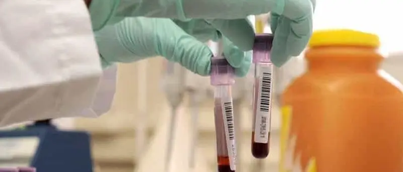 Covid, Regione aderisce a progetto europeo per raccolta plasma