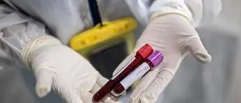 Covid Basilicata, 186 nuovi contagi e 1 morto: bollettino