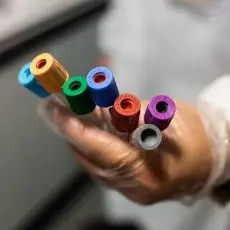 Bollettino Piemonte, oggi 1.439 contagi e 70 morti: i dati del 14 aprile